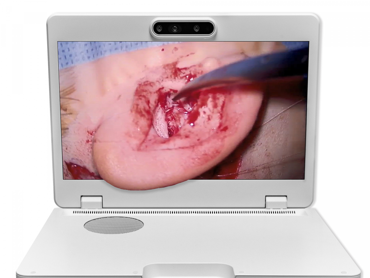 达擎之＂Heads-up 3D显微手术显示系统＂，整合4K裸眼3D显示及眼球追踪系统，具备快速追踪人眼移动位置功能，减轻医师长时间维持固定姿势的负担，让医师能有更宽广清晰的3D立体视野及更舒适的姿势来执行手术。